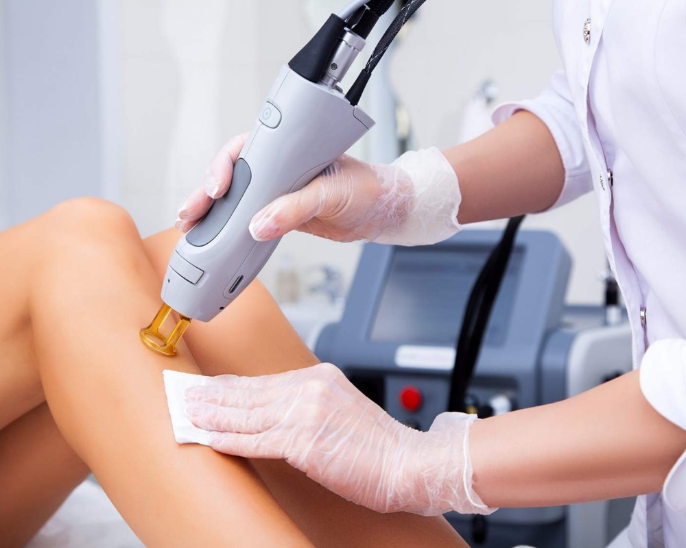 Laser Hair Removal